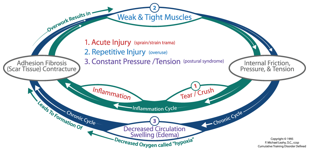 Cumulative Injury Cycle